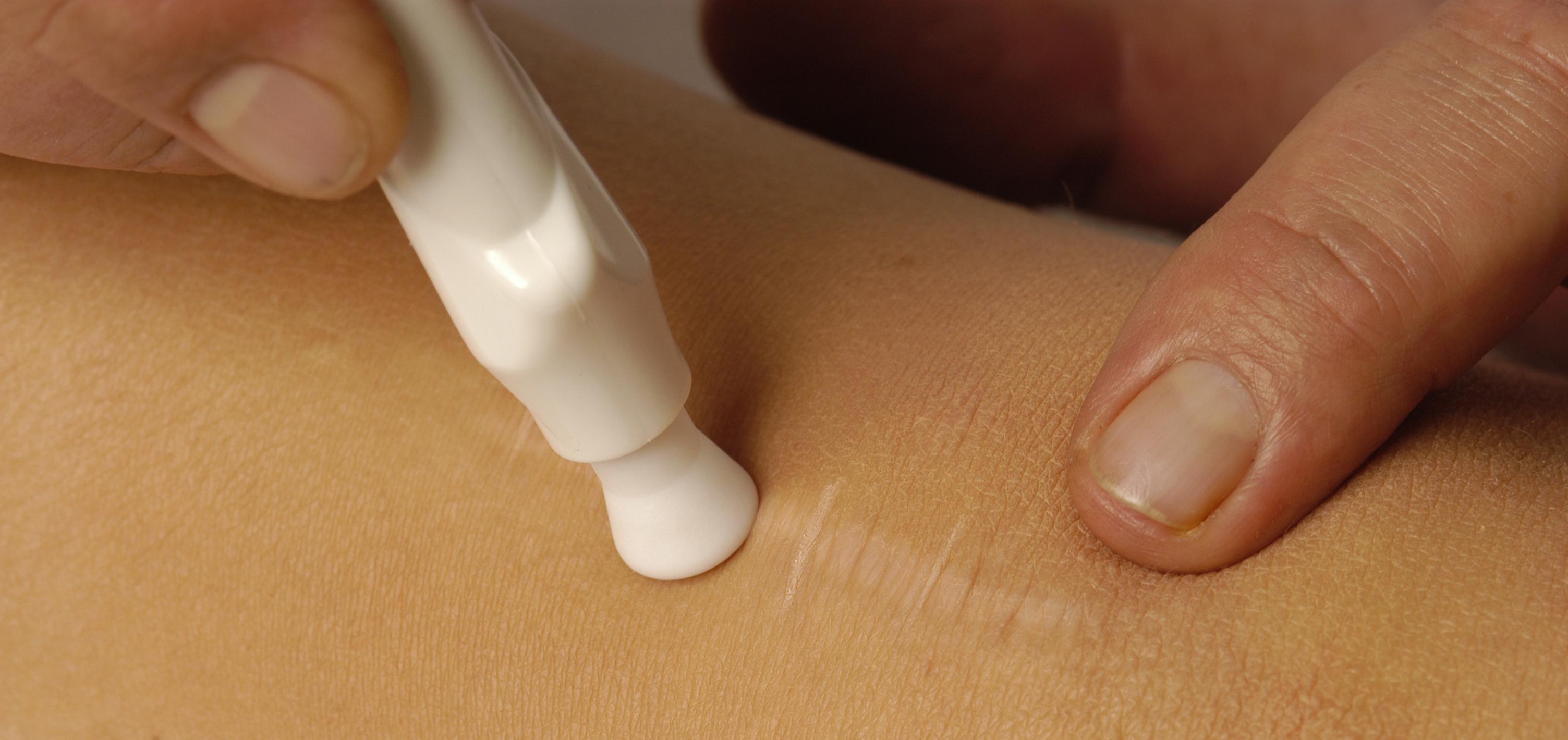 Soin cicatrice genou